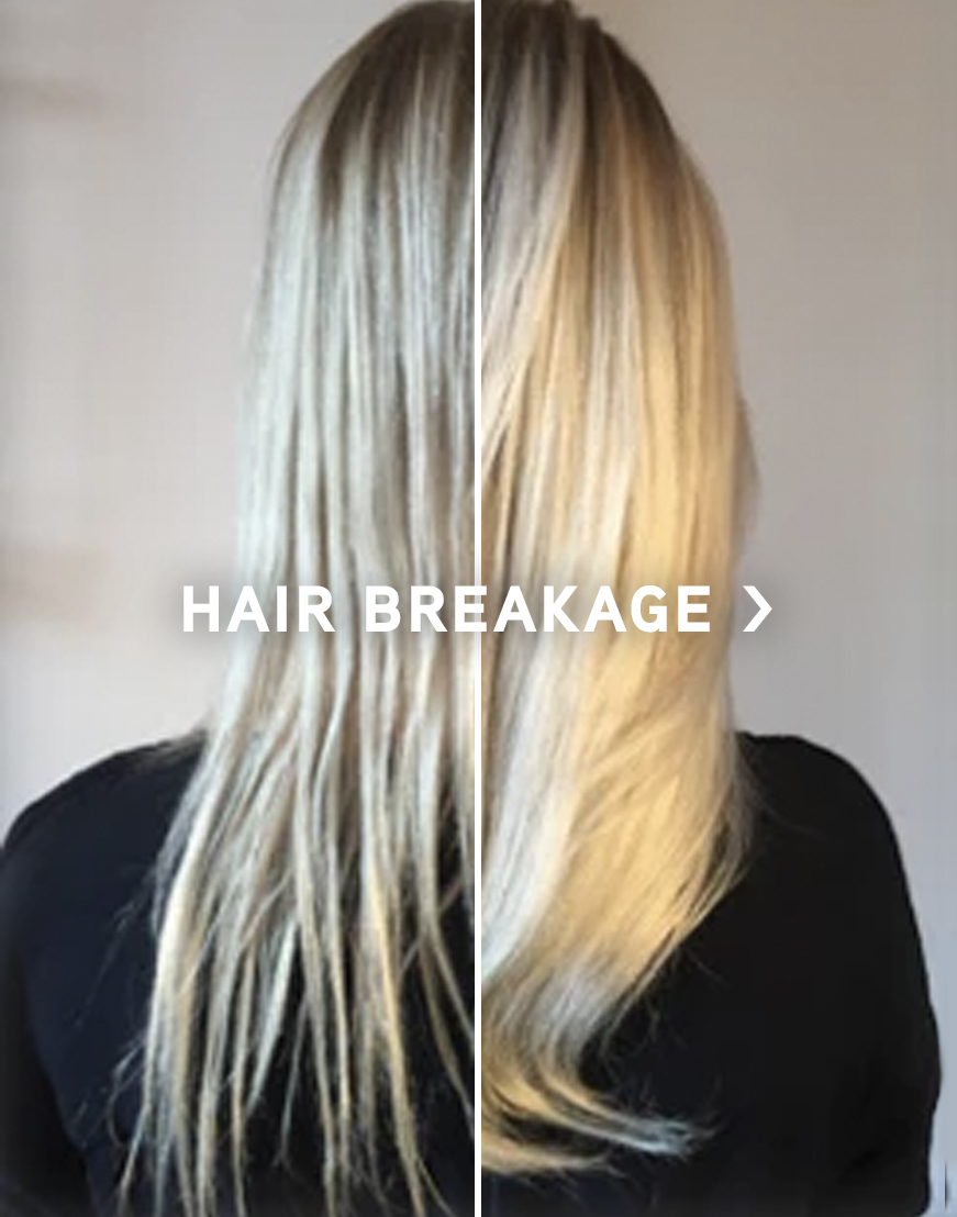 Hair Breakage
