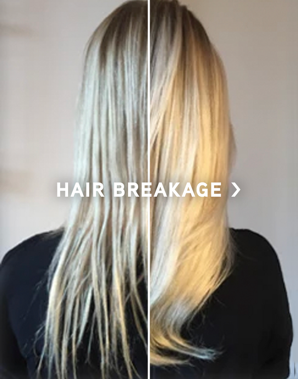 Hair Breakage