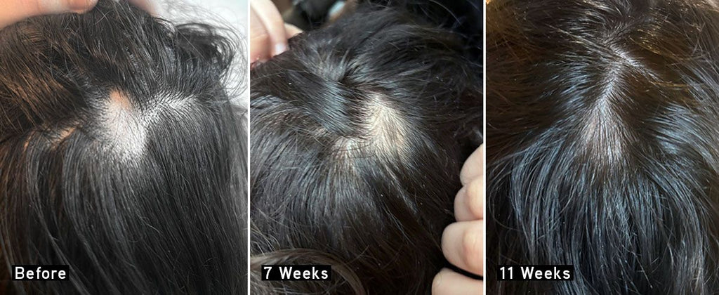 SCALP + HAIR REJUVENATING BOOSTER 